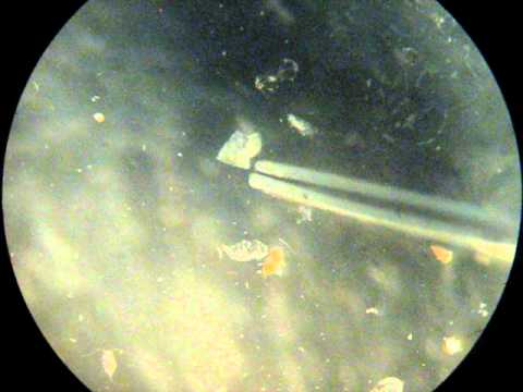 chaetognato y larva de anellida en muestra de zooplancton