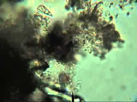 Fish Tank Filter Organisms Under a Microscope.flv