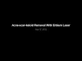 Video: Acne Keloid-Scar Removal - Fotona Erbium Laser