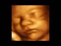 Click to View : Video USG 4 Dimensi