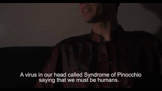 Trailer Syndrome of Pinocchio / Sindrome de Pinocchio versão 2K
