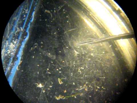pequeña meduza en muestra de zooplancton