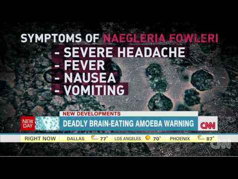 Deadly brain-eating amoeba warning   7/15/14  (Virus)
