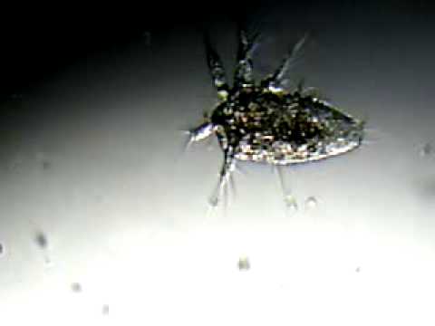 Restos de zooplancton (Umia 2011) 2.3gp