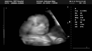 Singapore Short Film Festival Trailer Sun Koh by Wesley Leon Aroozoo Singapore Short Film Festival Trailer Sun Koh by Wesley Leon Aroozoo