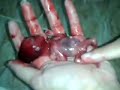 Image Gadis Arab Aborsi