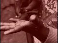 Main usée d'un enfant forcé de travailler