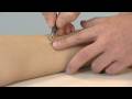 Acupuncture DVD - How to Locate  Acupuncture Points (LIV5)