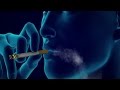 Smoking Causes COPD, Emphysema, Lung Cancer