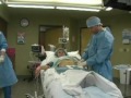 Video: Will TumLipoProcedure1NSC