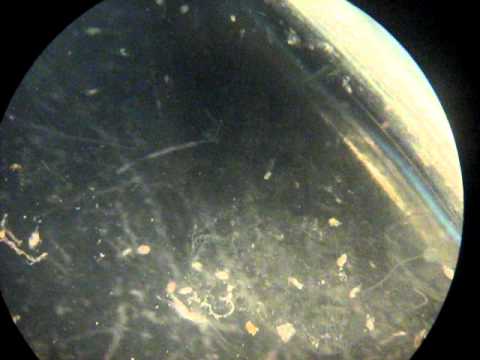 Medusa y larva de pez (ictio y zooplancton)