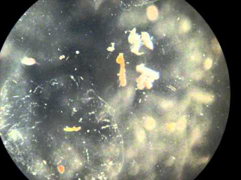 copepoditos en muestra de zooplancton