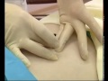 Фрагмент с середины видео Как лечиться пиявками Фрагмент с середины видео Как лечиться пиявками
