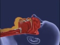Photo Tlcd Bipap Cipap Mask Flv