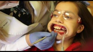 How braces are put on your teeth. Full procedure. EasyHow braces are put on your teeth. Full procedure. Easy