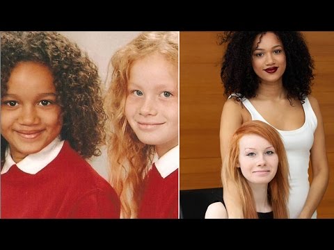 Twins With Completely Different Skin Colors Turns Heads In The UK