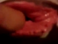 Photo Virgin S Pussy Medical Video