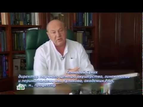 Тиреоидная дисфункция выпадение волос