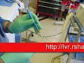 Image Operasi Peremajaan Vagina Dengan Metode Laser
