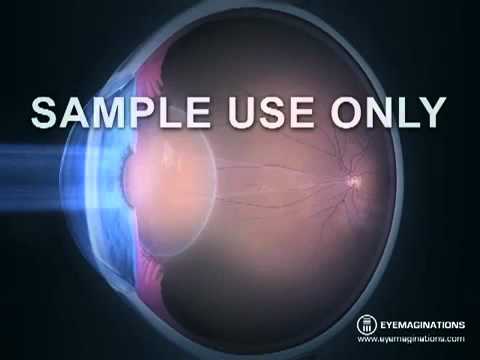 How the Eye Works (3D Medical Animation)