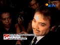Photo Bukti Kekerasan Marcella Zalianty Terhadap Agung Terungkap