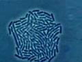 Vídeo mostra a Reprodução Bacteriana