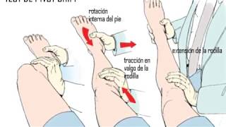 Resultado de imagen para pivot shift test