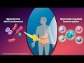Animation - What is Crohn's Disease?