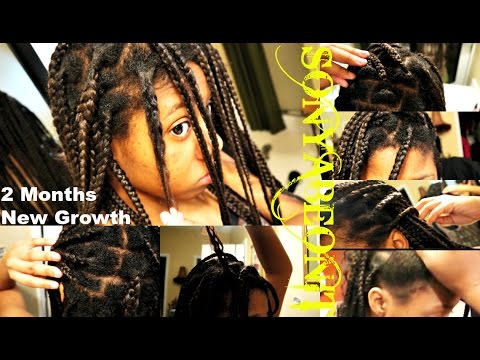 Update 2 Month New Growth Healthy No Knots Box Braids Relaxed