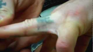 Criss Angel Tattoo Removal 10/13/12 - YouTube