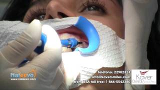 Procedimiento de Blanqueo Dental