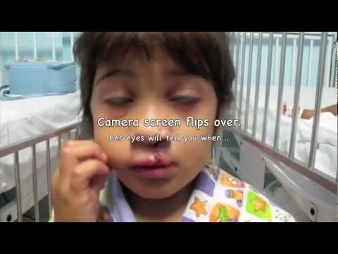 Changing faces with a smile - Operation Smile