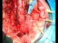 Image How A Man S Penis Is Turned Into A Vagina
