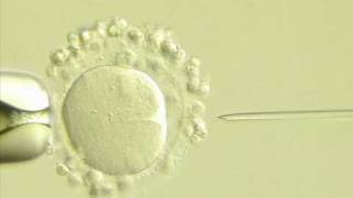 La inseminación artificial (parte 1)