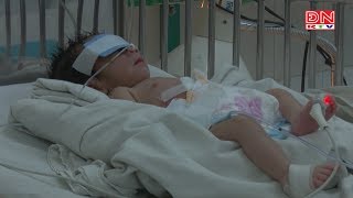 Phẫu thuật cứu bé trai sơ sinh bị dị tật hở thành bụng