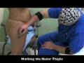 Video: SmartLipo - SlimLipo - VASER Lipo: Dr. Thomas E. Young - Young Medical Spa