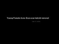 Video: Acne Scar-Keloid Laser Treatment
