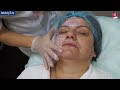Фрагмент с начала видео Лазерная шлифовка лица в центре косметологии Cleo Line Фрагмент с начала видео Лазерная шлифовка лица в центре косметологии Cleo Line