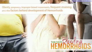 Stage 1 Hemorrhoids