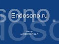 Нажмите для просмотра : Артрит плечевого сустава