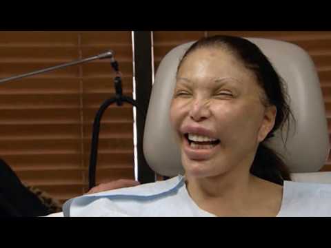 10 Worst Cases Of Plastic Surgery Gone Wrong - UCckDzKIPNKfSZYb647SQRwQ