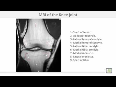 Anatomy 1 | C4 - L13 | Radiology of the lower limb