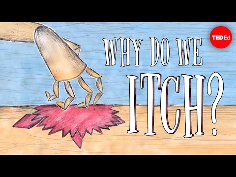 Why do we itch? - Emma Bryce - UCsooa4yRKGN_zEE8iknghZA