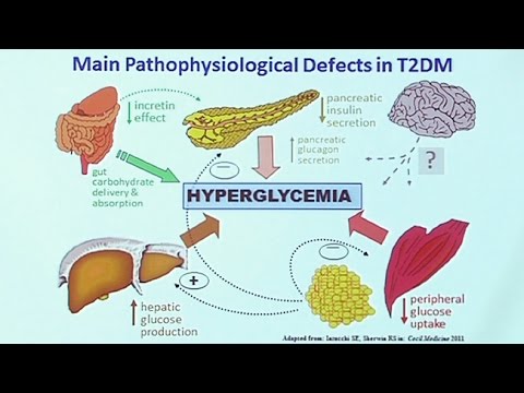 Making Sense of Diabetic Medications - UCh6KFtW4a4Ozr81GI1cxaBQ