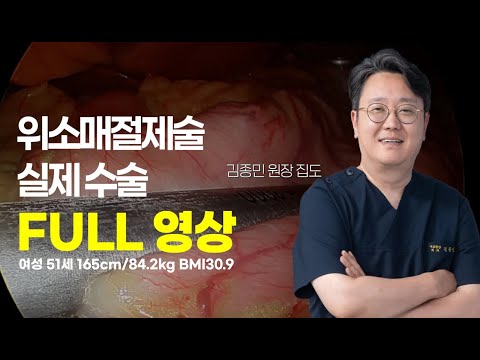 실제 위소매절제술이 어떻게 진행되는지 모..