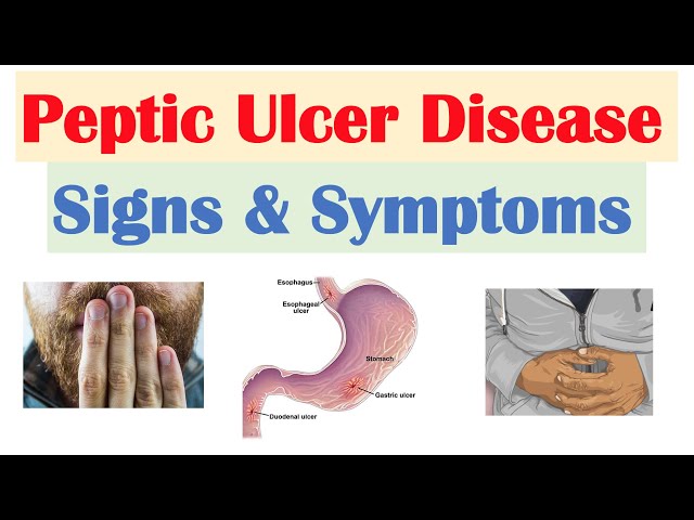 can-ulcers-cause-weight-loss-health-diseases