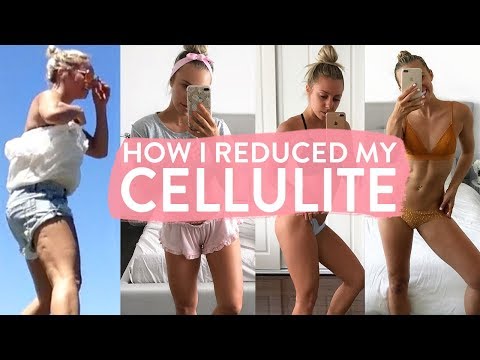 How I Reduced My CELLULITE | Tips, Food, Exercises & What Actually Works! - UCAHufvd02viJSRdt3ojdPOg