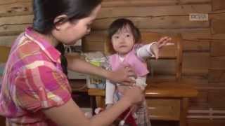 Вита - это жизнь. В Якутии живет девочка с редким в мире заболеванием