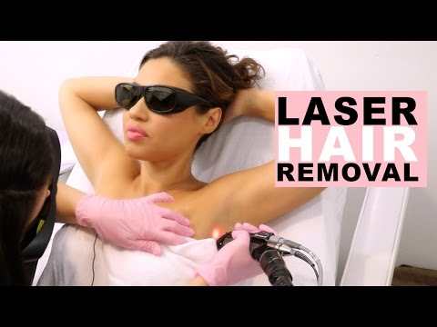 How To Laser Hair Removal For Women | My Laser Hair Removal Journey  | Eman - UCaZZh0mI6NoGTlmeI6dbP7Q