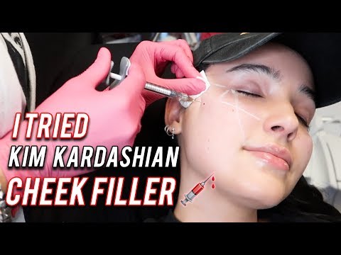 I GOT KIM KARDASHIAN CHEEK & LIP FILLER | Amanda Ensing - UCEZtkE45zjun9zROKtcqOcQ